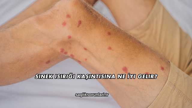 Sinek Isırığı Kaşıntısına Ne İyi Gelir?