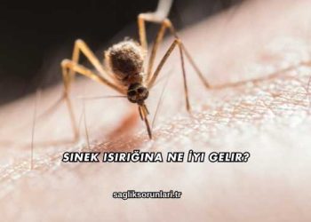 Sinek Isırığına Ne İyi Gelir?