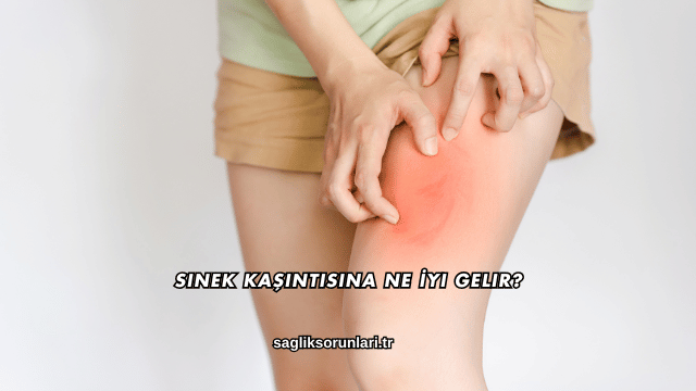 Sinek Kaşıntısına Ne İyi Gelir?