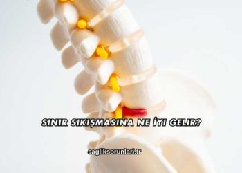 Sinir Sıkışmasına Ne İyi Gelir?