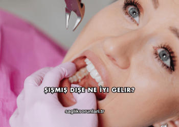 Şişmiş Dişe Ne İyi Gelir?