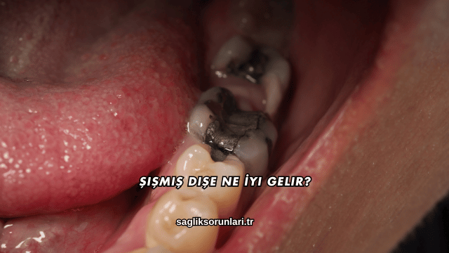 Şişmiş Dişe Ne İyi Gelir?