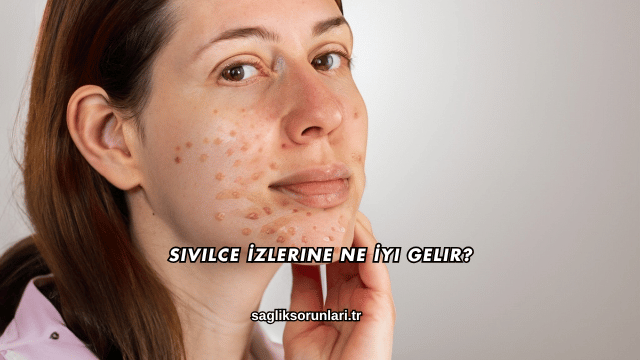 Sivilce İzlerine Ne İyi Gelir?