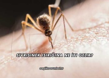Sivrisinek Isırığına Ne İyi Gelir?