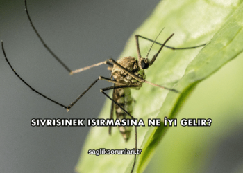 Sivrisinek Isırmasına Ne İyi Gelir?