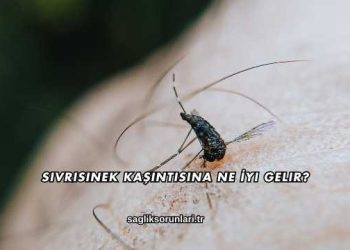 Sivrisinek Kaşıntısına Ne İyi Gelir?