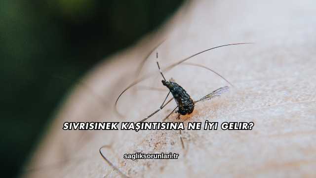 Sivrisinek Kaşıntısına Ne İyi Gelir?