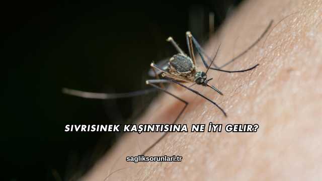 Sivrisinek Kaşıntısına Ne İyi Gelir?