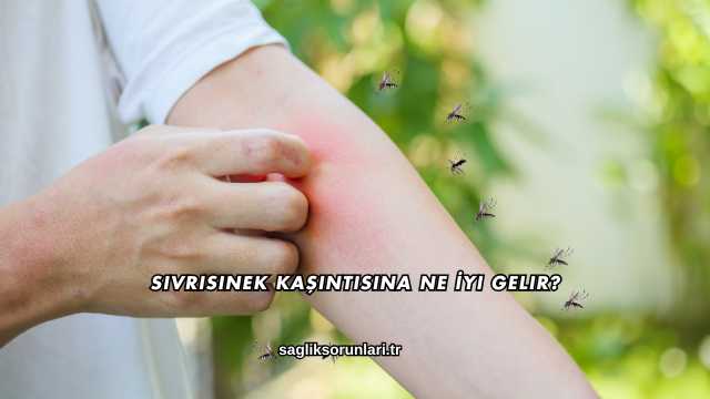 Sivrisinek Kaşıntısına Ne İyi Gelir?