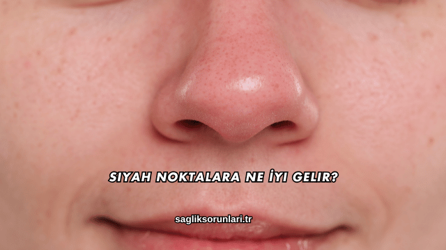 Siyah Noktalara Ne İyi Gelir?