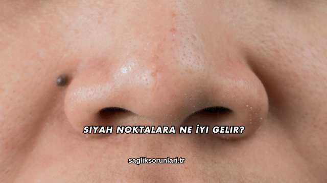 Siyah Noktalara Ne İyi Gelir?