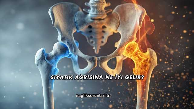 Siyatik Ağrısına Ne İyi Gelir?