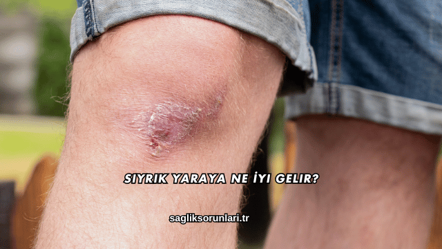 Sıyrık Yaraya Ne İyi Gelir?