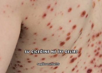 Su Çiçeğine Ne İyi Gelir?