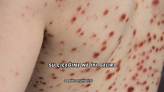 Su Çiçeğine Ne İyi Gelir?