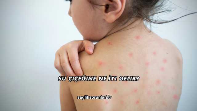 Su Çiçeğine Ne İyi Gelir?