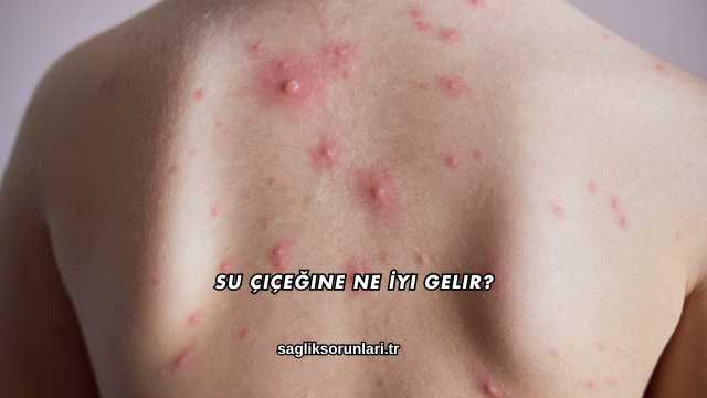 Su Çiçeğine Ne İyi Gelir?