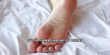 Su Toplamasına Ne İyi Gelir?