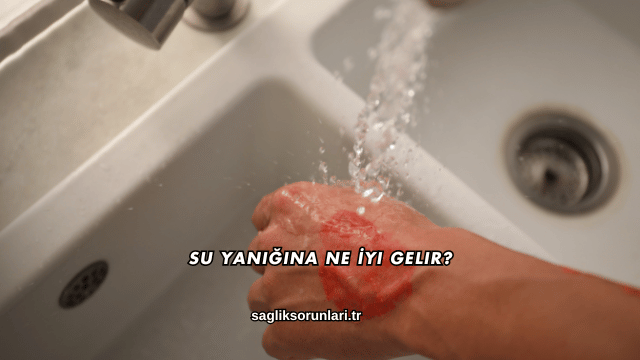 Su Yanığına Ne İyi Gelir?