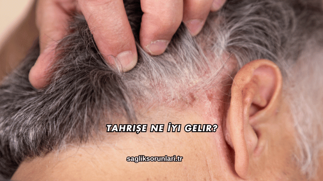 Tahrişe Ne İyi Gelir?