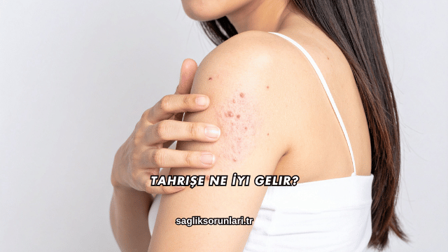 Tahrişe Ne İyi Gelir?