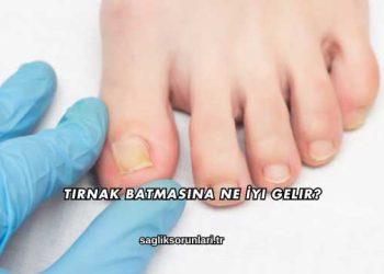 Tırnak Batmasına Ne İyi Gelir?