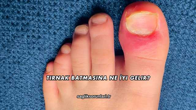 Tırnak Batmasına Ne İyi Gelir?