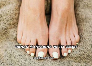 Tırnak Mantarına Ne İyi Gelir?