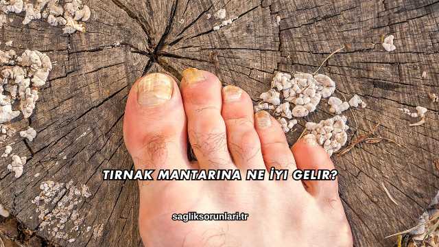Tırnak Mantarına Ne İyi Gelir?