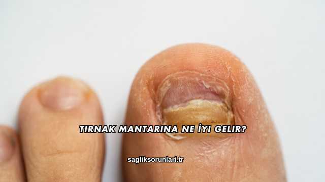 Tırnak Mantarına Ne İyi Gelir?