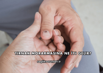 Tırnak Morarmasına Ne İyi Gelir?