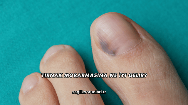 Tırnak Morarmasına Ne İyi Gelir?