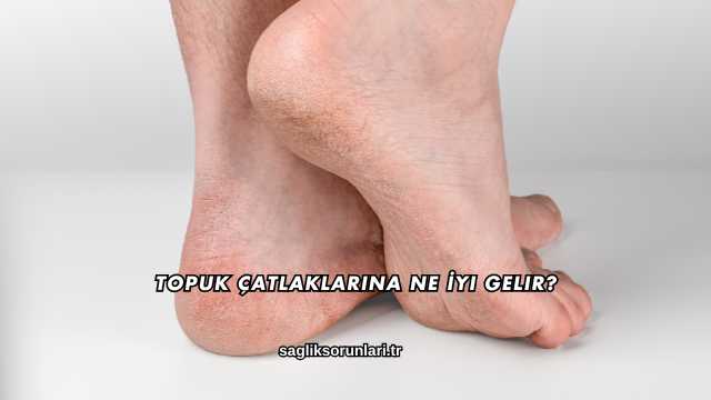 Topuk Çatlaklarına Ne İyi Gelir?