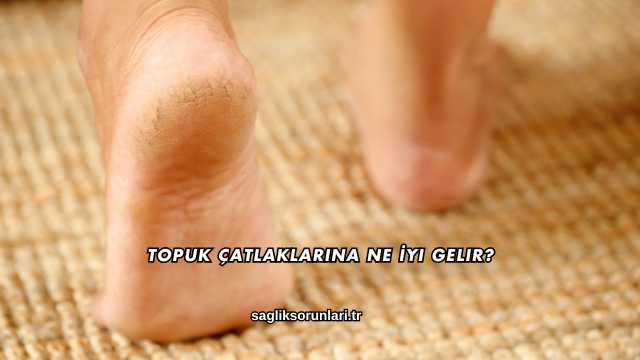 Topuk Çatlaklarına Ne İyi Gelir?