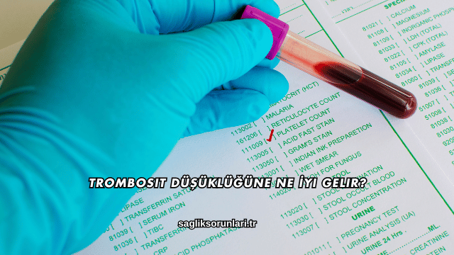 Trombosit Düşüklüğüne Ne İyi Gelir?