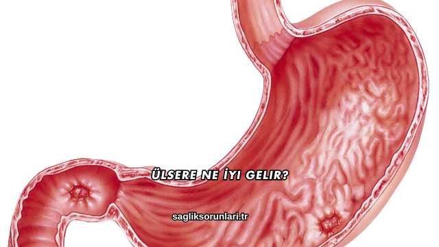 Ülsere Ne İyi Gelir?