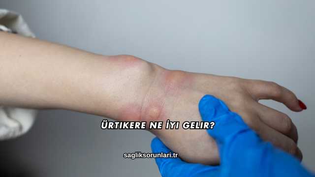 Ürtikere Ne İyi Gelir?