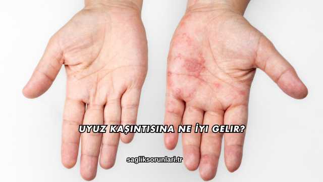 Uyuz Kaşıntısına Ne İyi Gelir?