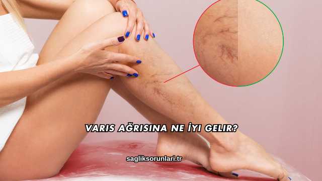 Varis Ağrısına Ne İyi Gelir?