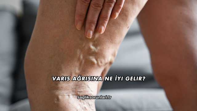 Varis Ağrısına Ne İyi Gelir?