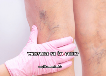 Varislere Ne İyi Gelir?