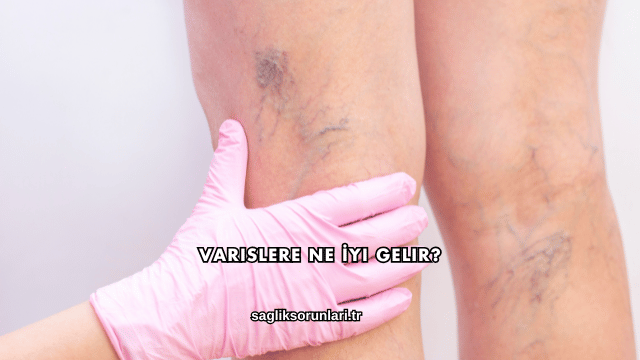 Varislere Ne İyi Gelir?