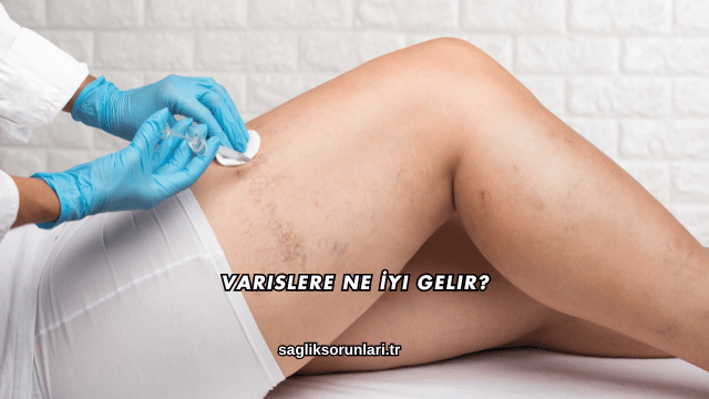 Varislere Ne İyi Gelir?