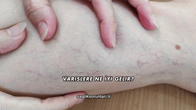 Varislere Ne İyi Gelir?