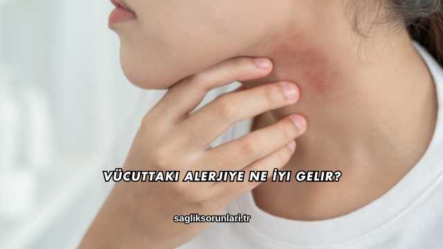 Vücuttaki Alerjiye Ne İyi Gelir?