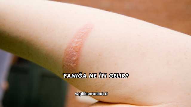 Yanığa Ne İyi Gelir?