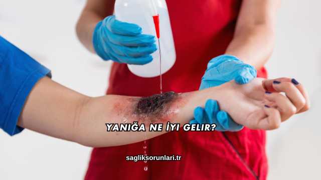 Yanığa Ne İyi Gelir?