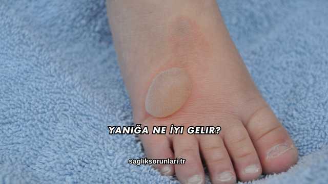Yanığa Ne İyi Gelir?