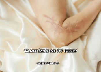 Yanık İzine Ne İyi Gelir?