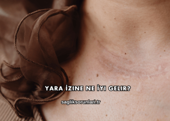 Yara İzine Ne İyi Gelir?